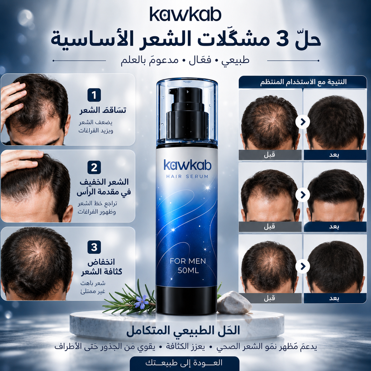 Kawkab Hair Growth Serum for Men with Rosemary, Biotin and Peptides, Helps Reduce Hair Fall and Breakage, Supports Thicker-Looking Hair, Silicone-Free, 50ml