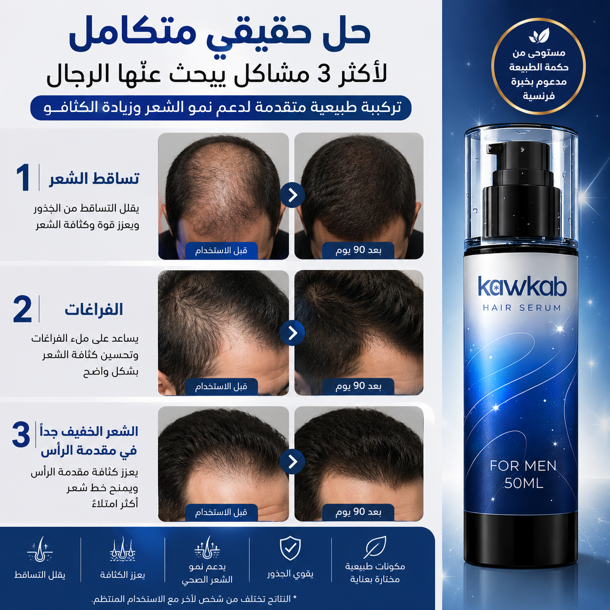 Kawkab Hair Serum for Men - سيروم الشعر للرجال