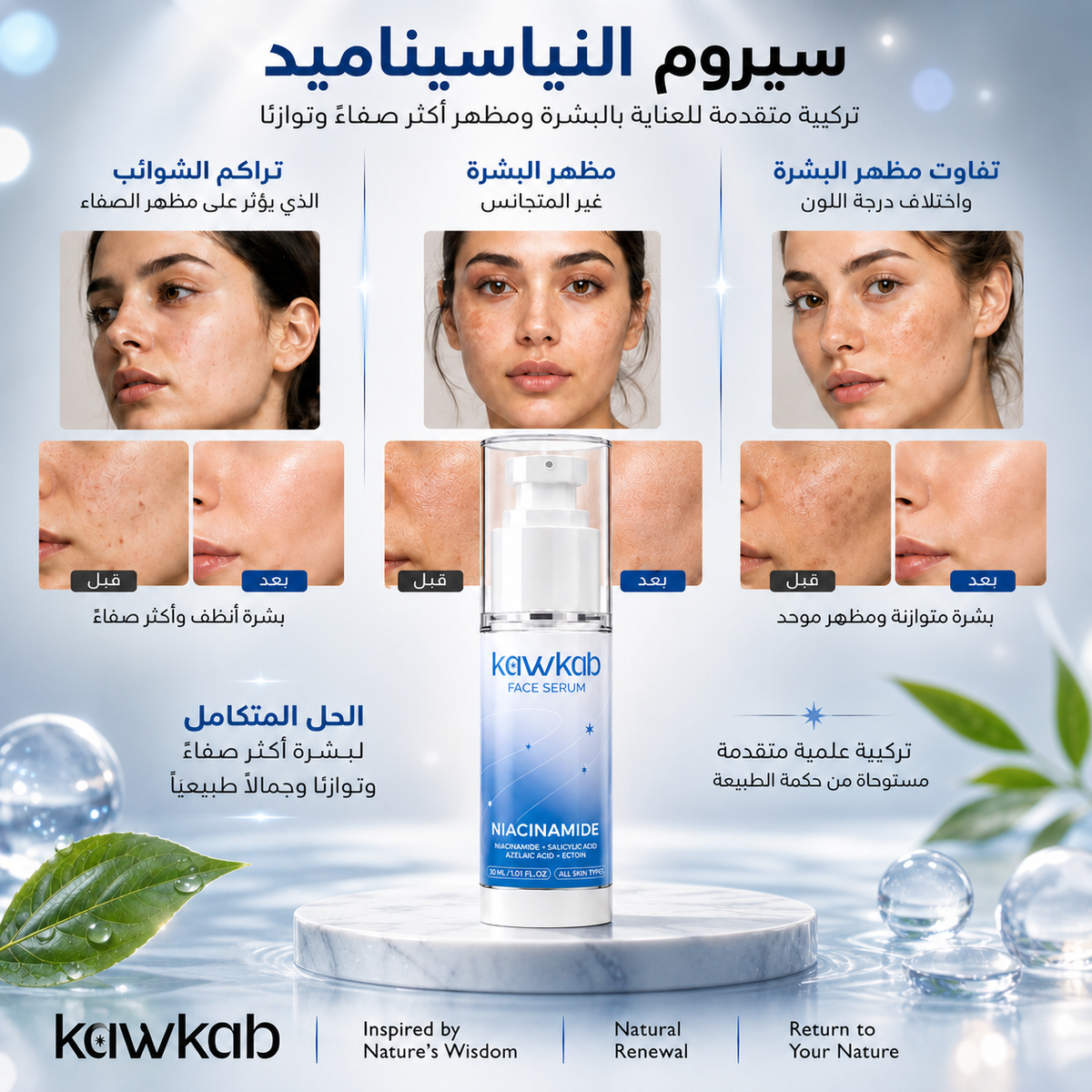 Kawkab Balance Niacinamide Face Serum with Salicylic Acid, Azelaic Acid and Ectoin, Pore Care and Oil Control for Oily and Combination Skin, Fragrance-Free, 30ml